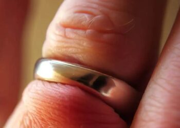 Strażacy pomogli w nietypowej interwencji. Obrączka zagrażała zdrowiu mężczyzny