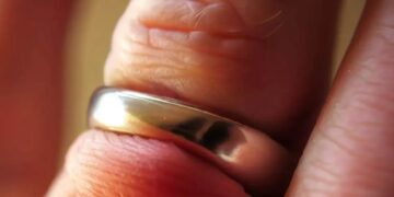 Strażacy pomogli w nietypowej interwencji. Obrączka zagrażała zdrowiu mężczyzny